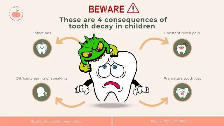 These are 4 Consequences of Tooth Decay in Children in Fairfax, VA